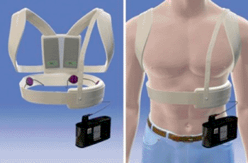 Image: The Zoll LifeVest wearable defibrillator (Photo courtesy of ZOLL Medical Corporation).
